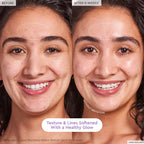 Before-and-after photo of a 23-year-old using Glow Recipe Blackberry Retinol Blemish Serum showing clearer, less discolored skin.