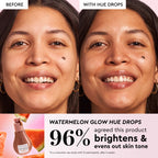 Infographic slide highlighting the Mini Watermelon Glow Niacinamide Dew Drops for fading dark spots.