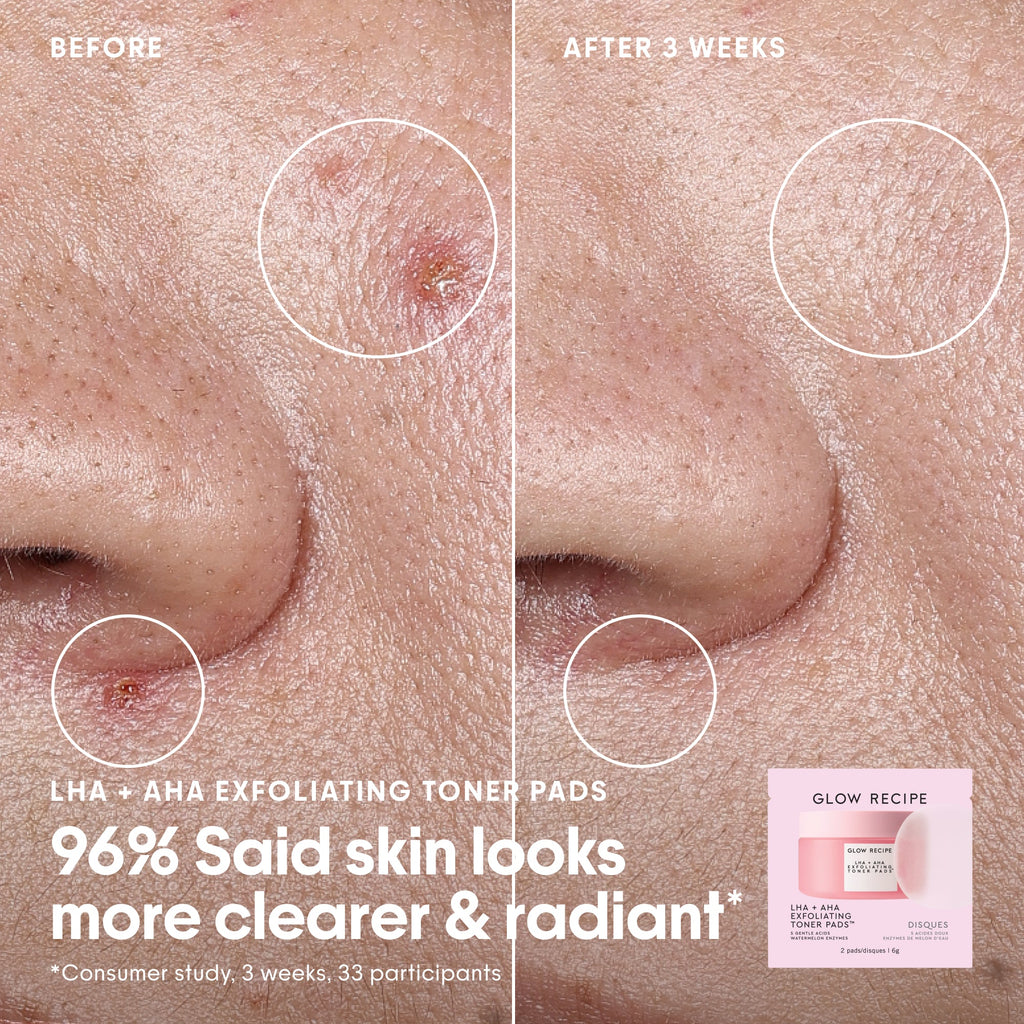 Watermelon Glass Skin Essentials Kit