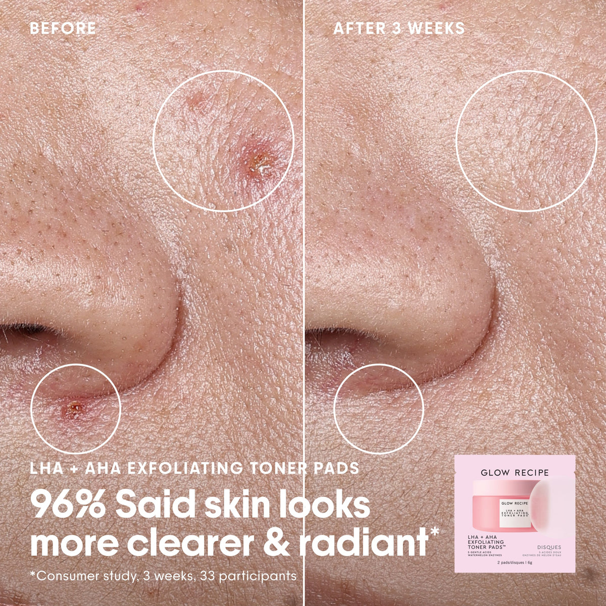 Watermelon Glass Skin Essentials Kit