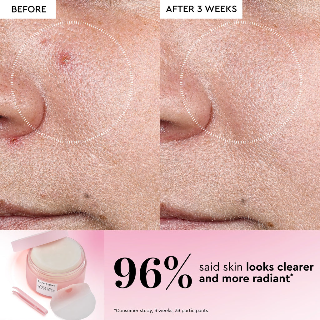 Glow Recipe LHA + AHA Toner Pad infographic showing pore-refining results from the 5-minute sachet treatment