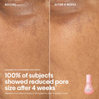 Watermelon Glass Skin Essentials Kit