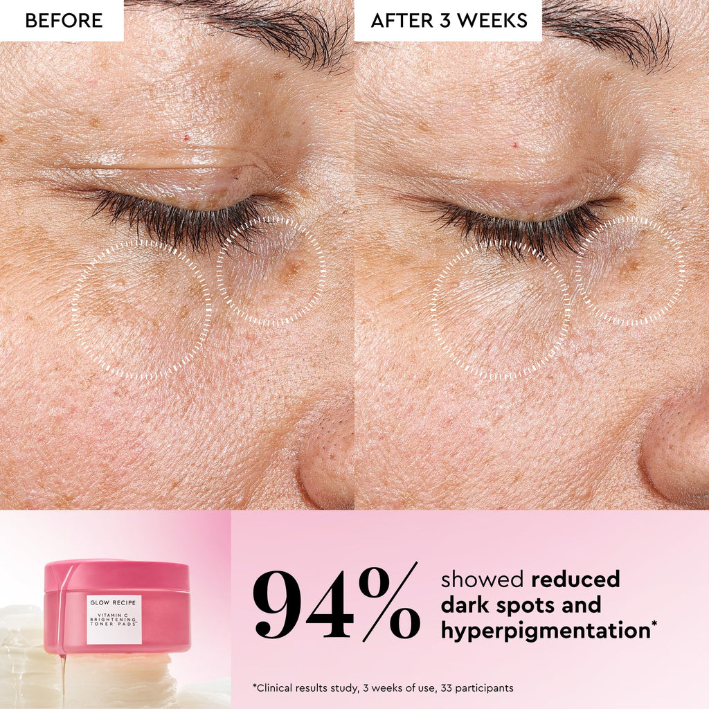 Infographic slide introducing the pads' 5 types of Vitamin C formulated to visibly fade dark spots and brighten dull skin.