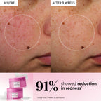 Glow Recipe PDRN+ Repair + Soothe Korean Toner Pads infographic explaining how the formula calms irritation and redness.