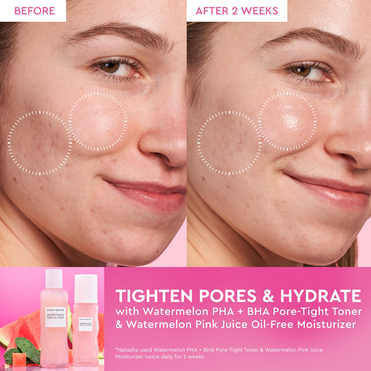 Watermelon Glow Dewy Skin Routine infographic showing a before-and-after toning result beside the Travel Size (40ml) toner.