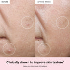 Glow Recipe Watermelon Glow Niacinamide Dew Drops infographic explaining how niacinamide visibly brightens skin.