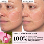 Infographic showcasing the Mini Watermelon Glow Niacinamide Dew Drops for brightening the look of dark spots.