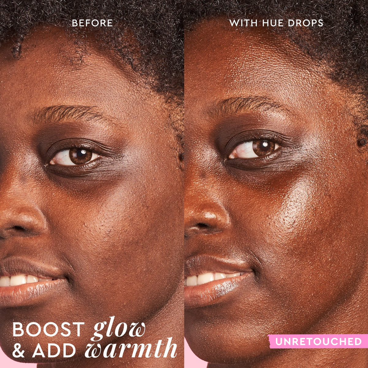 Before-and-after result of Watermelon Glow Niacinamide Hue Drops, illustrating its brightening, non-streaky finish.